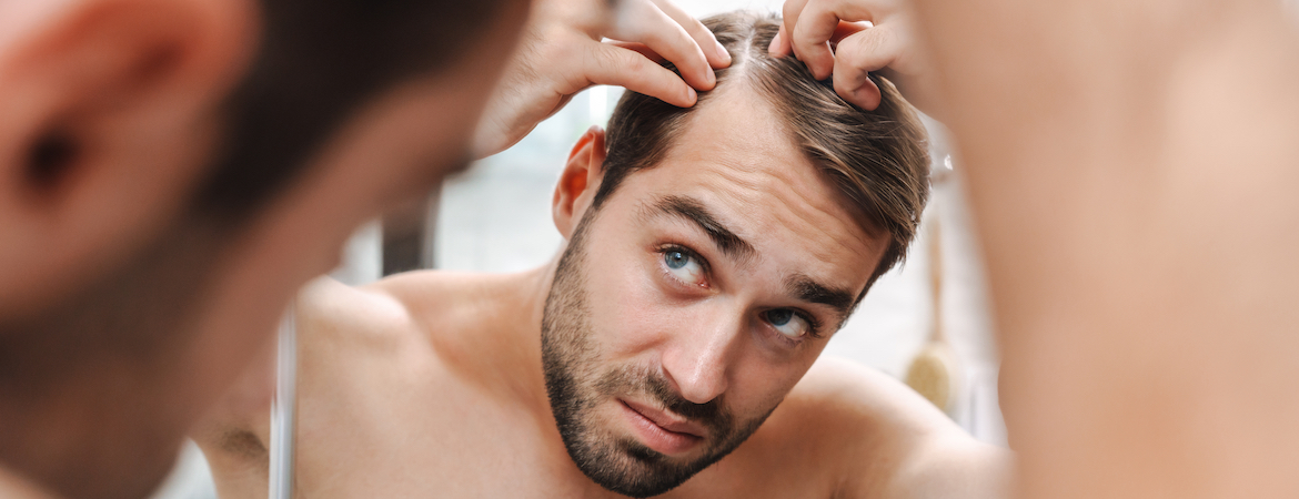 Hair loss products on sale for men